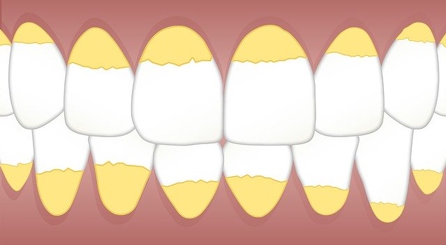 Erfahren Sie alles zu Zahnradierern!